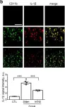 Fig.2.B showing Immunocytochemistry-immunofluorescence in a Rattus norvegicus (Rat) sample from the publication: Vagal afferent fibers contribute to the anti-inflammatory reactions by vagus nerve stimulation in concanavalin A model of hepatitis in rats.