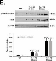 Fig.1.E showing Western Blotting from the publication: The critical role of the proto-oncogene c-Kit in TSC renal cystogenesis.