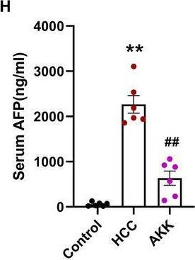 Fig.4.H showing Enzyme-linked immunosorbent assay from the publication: 5,7-dimethoxyflavone inhibits hepatocellular carcinoma progression via increasing intestinal Akkermansia muciniphila and hepatic CD8+ T cell infiltration.