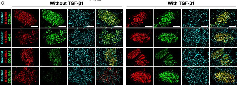 Fig.6.C showing Immunocytochemistry-immunofluorescence from the publication: Fibroblast Growth Factor 2-Immobilized Biointerfaces Drive Exogenous Transforming Growth Factor β1-Independent Chondrogenesis of Human Mesenchymal Stem Cell and Ectopic Cartilage Tissue Formation.