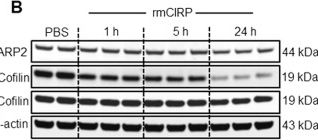 Fig.3.B showing Western Blotting in a Mus musculus (House mouse) sample from the publication: Extracellular CIRP dysregulates macrophage bacterial phagocytosis in sepsis.