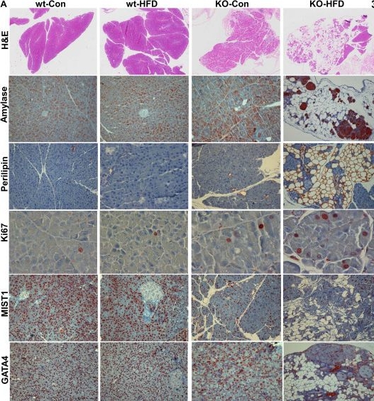 Fig.4.A showing Immunohistochemistry from the publication: Heparanase 2 (Hpa2) protects the exocrine pancreas from damages of Western diet and pancreatic cancer.