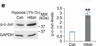 Cytotoxin / Radiophobia【輸入盤】 Elucidating the role of transiently hypoxic tumour cells on