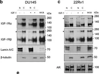 Fig.1.C showing Western Blotting in a Homo sapiens (Human) sample from the publication: IGF-1R nuclear import and recruitment to chromatin involves both alpha and beta subunits.