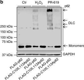 Oxidation of SQSTM1/p62 mediates the link between redox state and protein homeostasis.
