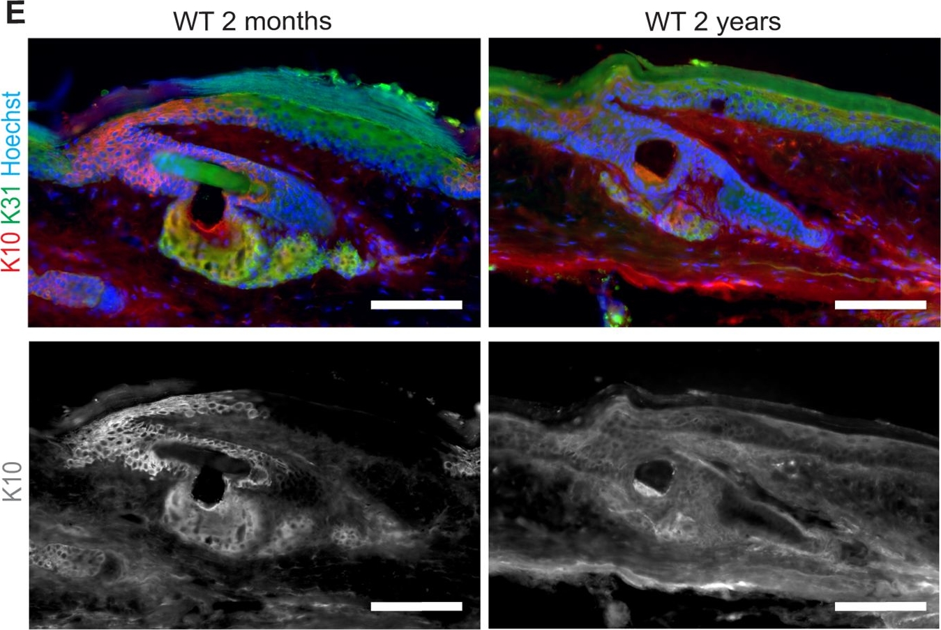 Wild-type and SAMP8 mice show age-dependent changes in distinct stem cell compartments of the interfollicular epidermis.