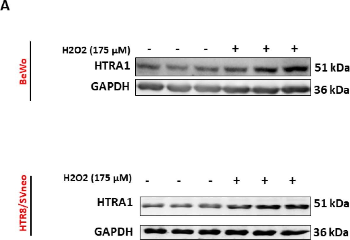 Fig.2.A showing Western Blotting in a Homo sapiens (Human) sample from the publication: HTRA1 in Placental Cell Models: A Possible Role in Preeclampsia.