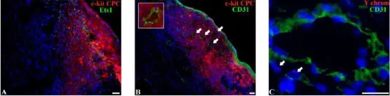 Fig.5.C showing Immunohistochemistry in a Rattus norvegicus (Rat) sample from the publication: C-Kit Cardiac Progenitor Cell Based Cell Sheet Improves Vascularization and Attenuates Cardiac Remodeling following Myocardial Infarction in Rats.