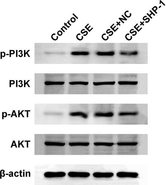 Fig.5.A showing Western Blotting in a Homo sapiens (Human) sample from the publication: SHP-1 mediates cigarette smoke extract-induced epithelial-mesenchymal transformation and inflammation in 16HBE cells.