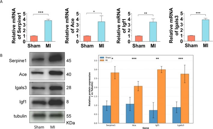 Fig.7.A showing Western Blotting in a Mus musculus (House mouse) sample from the publication: Exploration of the Potential Mechanism of Metal Ion Transport-Related Genes in Myocardial Infarction Based on Transcriptomics.