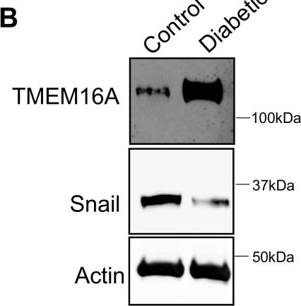 Fig.2.B showing Western Blotting from the publication: Extracellular glucose and dysfunctional insulin receptor signaling independently upregulate arterial smooth muscle TMEM16A expression.