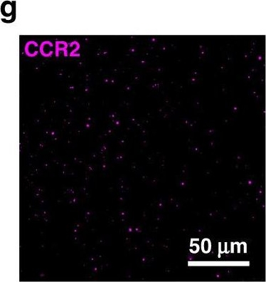 Fig.3.G showing Immunohistochemistry in a Rattus norvegicus (Rat) sample from the publication: Soft monolithic infrared neural interface for simultaneous neurostimulation and electrophysiology.