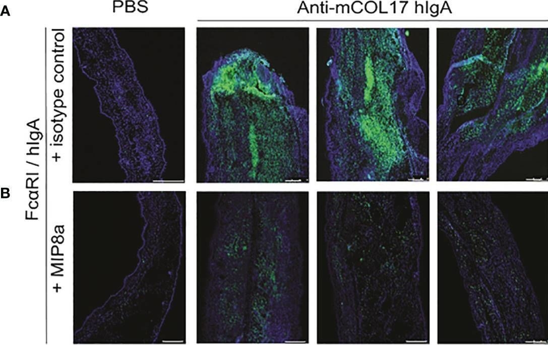 Fig.5.A showing Immunohistochemistry-immunofluorescence in a Mus musculus (House mouse) sample from the publication: Anti-FcαRI Monoclonal Antibodies Resolve IgA Autoantibody-Mediated Disease.