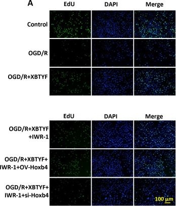 Fig.8.A showing Immunocytochemistry-immunofluorescence from the publication: Hoxb4 upregulation by Xuan Bi Tong Yu Fang confers cardioprotection via repression of the Wnt/β-catenin pathway in myocardial ischemia-reperfusion injury.
