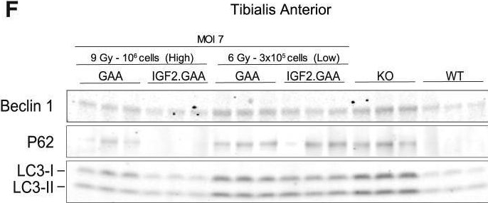 Fig.3.F showing Western Blotting from the publication: IGF2-tagging of GAA promotes full correction of murine Pompe disease at a clinically relevant dosage of lentiviral gene therapy.