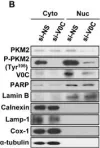 Fig.5.B showing Western Blotting in a Homo sapiens (Human) sample from the publication: Vacuolar H+-ATPase Subunit V0C Regulates Aerobic Glycolysis of Esophageal Cancer Cells via PKM2 Signaling.