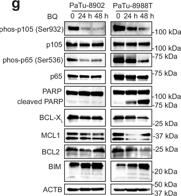 Fig.4.G showing Western Blotting from the publication: De novo pyrimidine biosynthesis inhibition synergizes with BCL-XL targeting in pancreatic cancer.