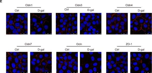 Fig.5.E showing Immunocytochemistry-immunofluorescence from the publication: Cellular Senescence Contributes to the Dysfunction of Tight Junctions in Submandibular Glands of Aging Mice.