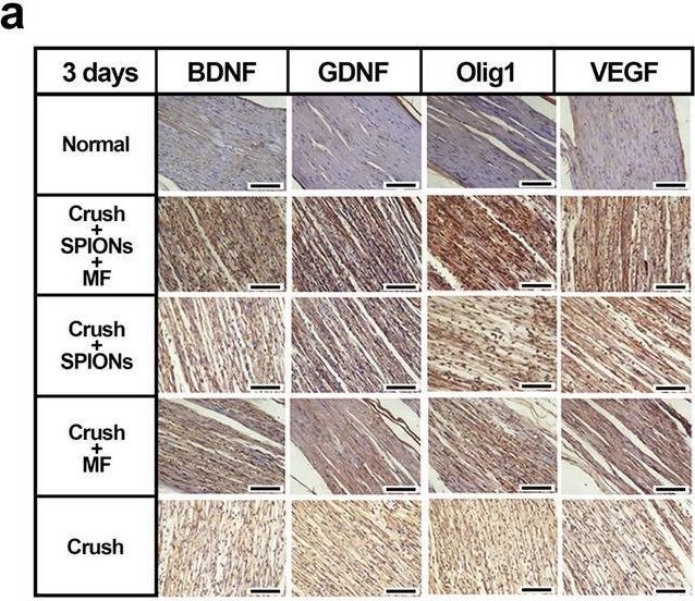 Fig.9.A showing Immunohistochemistry from the publication: SPIONs mediated magnetic actuation promotes nerve regeneration by inducing and maintaining repair-supportive phenotypes in Schwann cells.