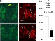 Fig.1.B showing Immunohistochemistry in a Mus musculus (House mouse) sample from the publication: Reversible cell cycle inhibition and premature aging features imposed by conditional expression of p16Ink4a.