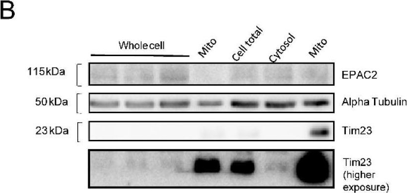 Fig.1.B showing Western Blotting from the publication: Pharmacological Inhibition of Epac1 Averts Ferroptosis Cell Death by Preserving Mitochondrial Integrity.