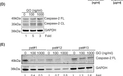 Fig.1.D showing Western Blotting from the publication: Caspase-2 is a mediator of apoptotic signaling in response to gemtuzumab ozogamicin in acute myeloid leukemia.
