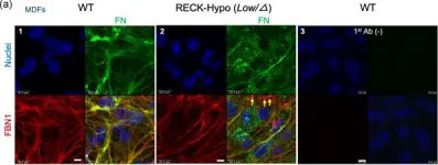 Fig.2.A showing Immunocytochemistry-immunofluorescence from the publication: Reversion-inducing cysteine-rich protein with Kazal motifs and MT1-MMP promote the formation of robust fibrillin fibers.