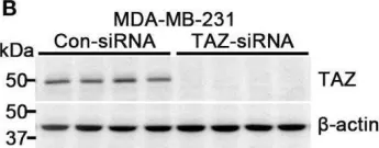 Fig.1.B showing Western Blotting in a Homo sapiens (Human) sample from the publication: TAZ is involved in breast cancer cell migration via regulating actin dynamics.