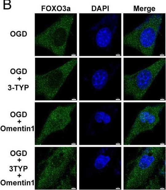 Fig.6.B showing Immunocytochemistry-immunofluorescence from the publication: Omentin1 ameliorates myocardial ischemia-induced heart failure via SIRT3/FOXO3a-dependent mitochondrial dynamical homeostasis and mitophagy.