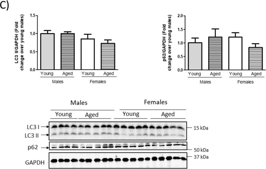 Cardiac GRK2 Protein Levels Show Sexual Dimorphism during Aging and Are Regulated by Ovarian Hormones.