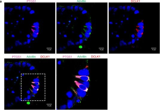 Fig.4.A showing Immunocytochemistry-immunofluorescence in a Mus musculus (House mouse) sample from the publication: Mouse intestinal tuft cells express advillin but not villin.