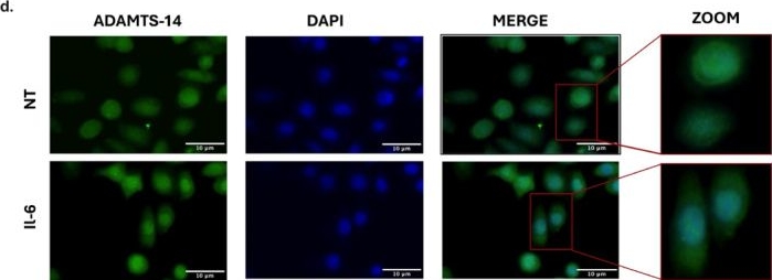 Fig.2.D showing Immunocytochemistry-immunofluorescence in a Homo sapiens (Human) sample from the publication: Inflammatory cytokine IL-6 regulates ADAMTS14 expression through MAPK and PI3K signaling in colorectal cancer.