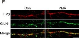 Fig.7.F showing Immunohistochemistry-immunofluorescence from the publication: Myosin Va-dependent Transport of NMDA Receptors in Hippocampal Neurons.