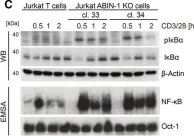 Fig.3.C showing Western Blotting from the publication: A20 and ABIN-1 cooperate in balancing CBM complex-triggered NF-κB signaling in activated T cells.