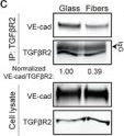 Fig.6.C showing Western Blotting from the publication: Perivascular Matrix Densification Dysregulates Angiogenesis and Activates Pro-Inflammatory Endothelial Cells.