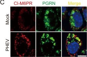 Fig.2.C showing Immunocytochemistry-immunofluorescence in a Mus musculus (House mouse) sample from the publication: Progranulin-driven lysosomal acidification facilitates exocytosis of PHEV-hijacked lysosomes for viral release.
