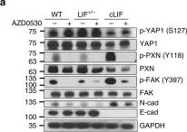 Fig.7.A showing Western Blotting in a Homo sapiens (Human) sample from the publication: Cytoplasmic LIF reprograms invasive mode to enhance NPC dissemination through modulating YAP1-FAK/PXN signaling.