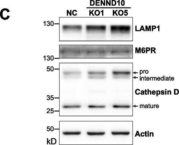 Fig.2.C showing Western Blotting in a Mus musculus (House mouse) sample from the publication: Endosomal protein DENND10/FAM45A integrates extracellular vesicle release with cancer cell migration.
