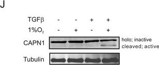 Fig.4.J showing Western Blotting from the publication: Hypoxia induces calpain activity and degrades SMAD2 to attenuate TGFβ signaling in macrophages.