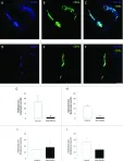 Fig.2.A,B,C,D,E,F,G,H,I,J showing Immunohistochemistry-immunofluorescence in a Mus musculus (House mouse) sample from the publication: NG2 proteoglycan-dependent recruitment of tumor macrophages promotes pericyte-endothelial cell interactions required for brain tumor vascularization.