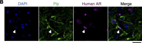 Fig.2.B showing Immunohistochemistry-immunofluorescence from the publication: Dysregulated synaptic gene expression in oligodendrocytes of spinal and bulbar muscular atrophy.