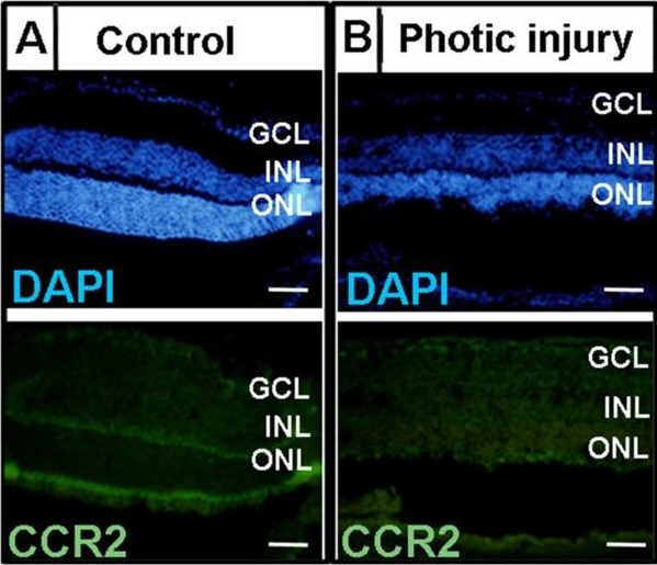 Fig.4.A showing Immunohistochemistry-immunofluorescence in a Muntiacus muntjak (Indian muntjac) sample from the publication: CCR1 mediates Müller cell activation and photoreceptor cell death in macular and retinal degeneration.