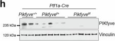 Fig.1.H showing Western Blotting from the publication: Targeting PIKfyve-driven lipid metabolism in pancreatic cancer.
