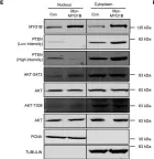 Fig.3.E showing Western Blotting from the publication: Myosin 1b Regulates Nuclear AKT Activation by Preventing Localization of PTEN in the Nucleus.