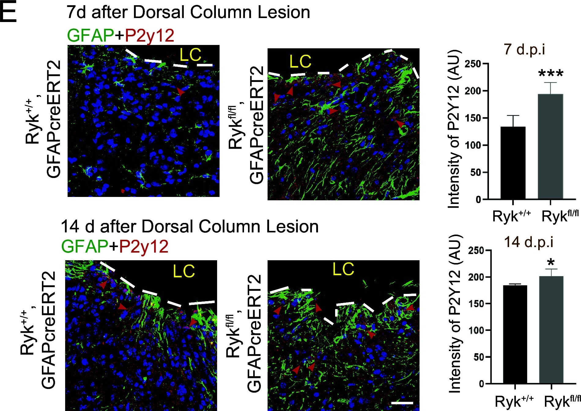 Fig.3.E showing Immunohistochemistry-immunofluorescence from the publication: Astrocytic Ryk signaling coordinates scarring and wound healing after spinal cord injury.
