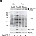 Fig.3.D showing Western Blotting from the publication: Variable behavior of iPSCs derived from CML patients for response to TKI and hematopoietic differentiation.