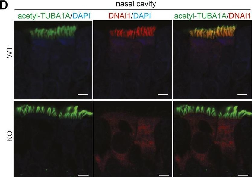 Fig.5.D showing Immunohistochemistry-immunofluorescence from the publication: PIH1D3-knockout rats exhibit full ciliopathy features and dysfunctional pre-assembly and loading of dynein arms in motile cilia.