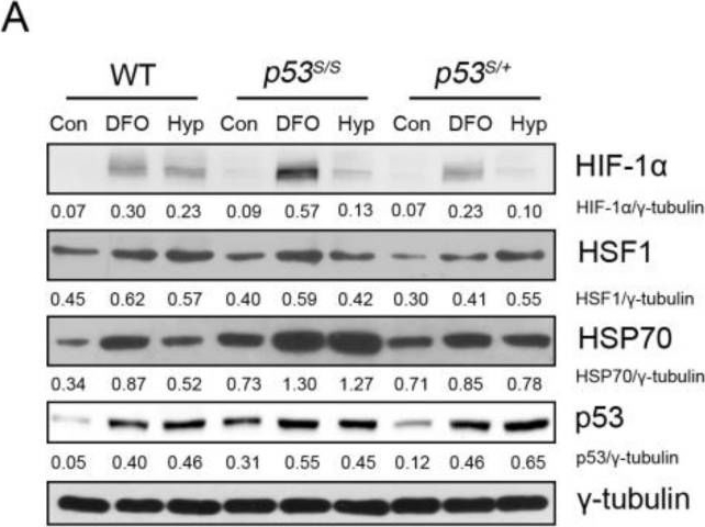 Fig.1.A showing Western Blotting from the publication: p53N236S Activates Autophagy in Response to Hypoxic Stress Induced by DFO.