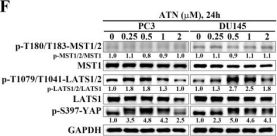 Phospho-YAP (Ser397) (D1E7Y) Rabbit Monoclonal Antibody | Cell