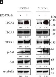 Fig.7.B showing Western Blotting in a Homo sapiens (Human) sample from the publication: VIRMA promotes nasopharyngeal carcinoma, tumorigenesis, and metastasis by upregulation of E2F7 in an m6A-dependent manner.